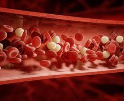 1 246x200 - 20代「白血病」の生存率は？（種類別まとめ）